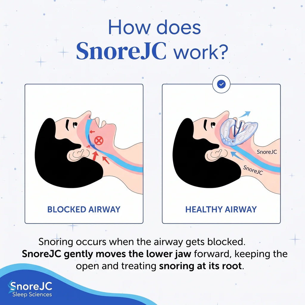 SnoreJC Premium® Anti-Snoring Mouthpiece